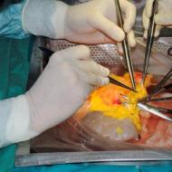 Orthodox view on organ transplantation Donors during transplantation