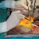 Ortodox nézet a szervátültetésről Donorok a transzplantáció során